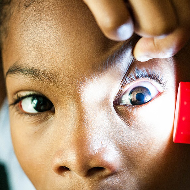 Flashlight shining at young person's eye, a hand used to pull eyelid up