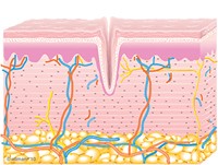 Diagram of Untreated Skin